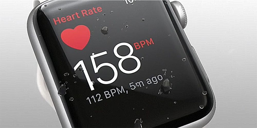 Kaip patikrinti pulsą naudojant Apple Watch