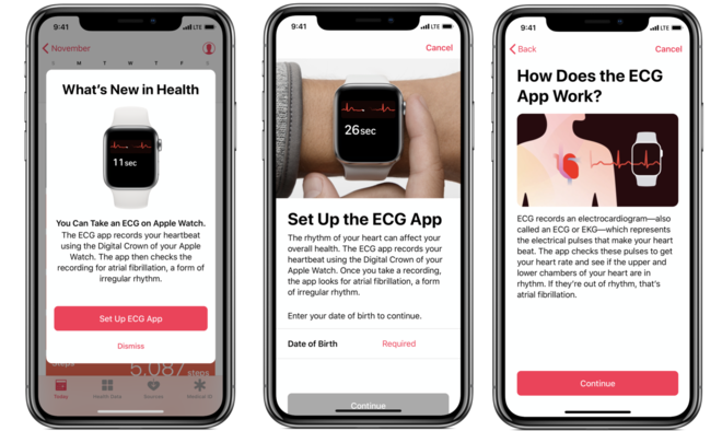 Apple Watch 4 and ECG